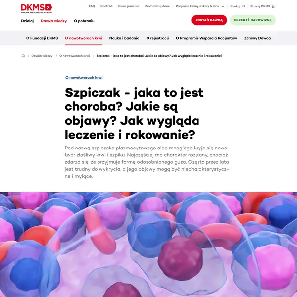 Szpiczak — objawy i leczenie