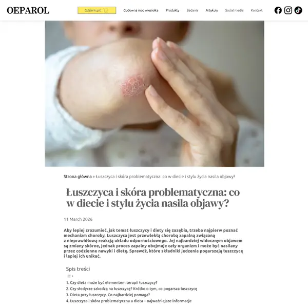 Łuszczyca a styl życia